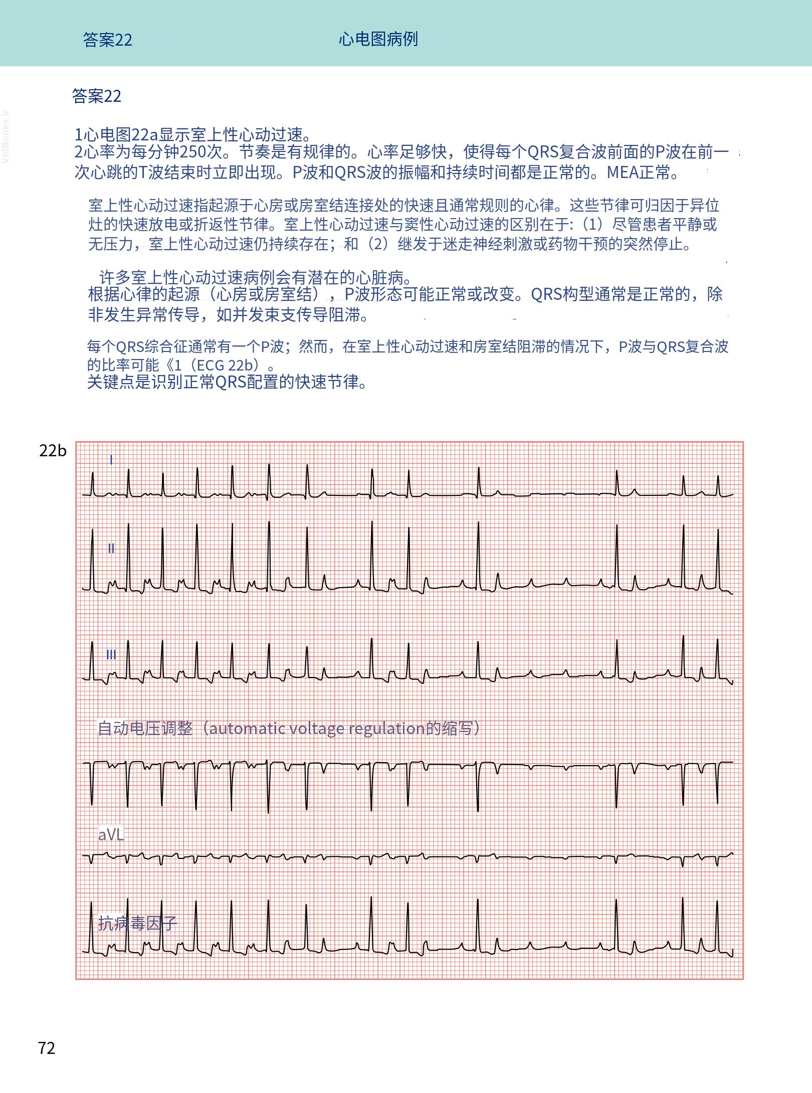 translated.08360f77efdd439f8d33c7a2dc6aedd5_85.png