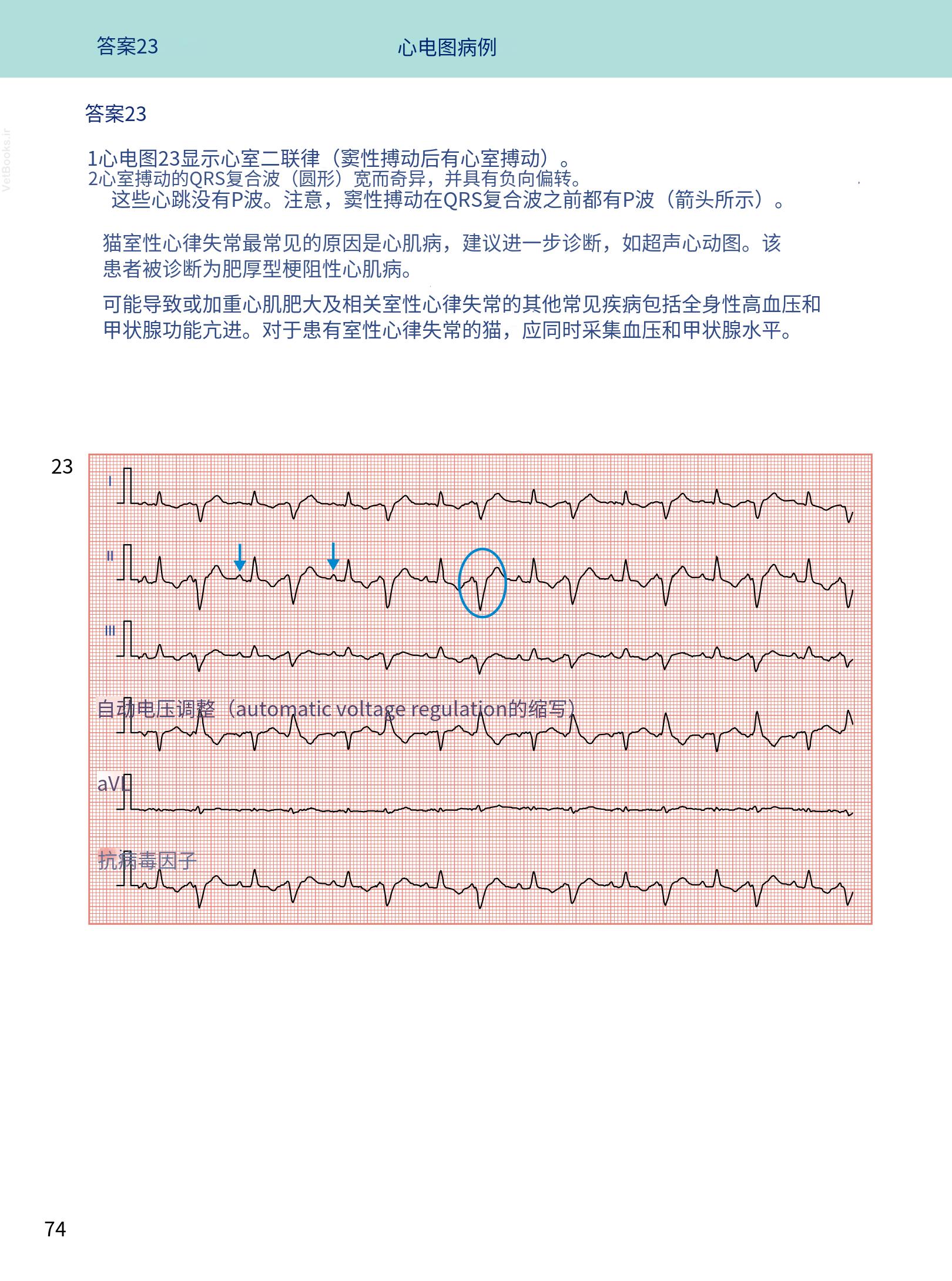 translated.08360f77efdd439f8d33c7a2dc6aedd5_87.png