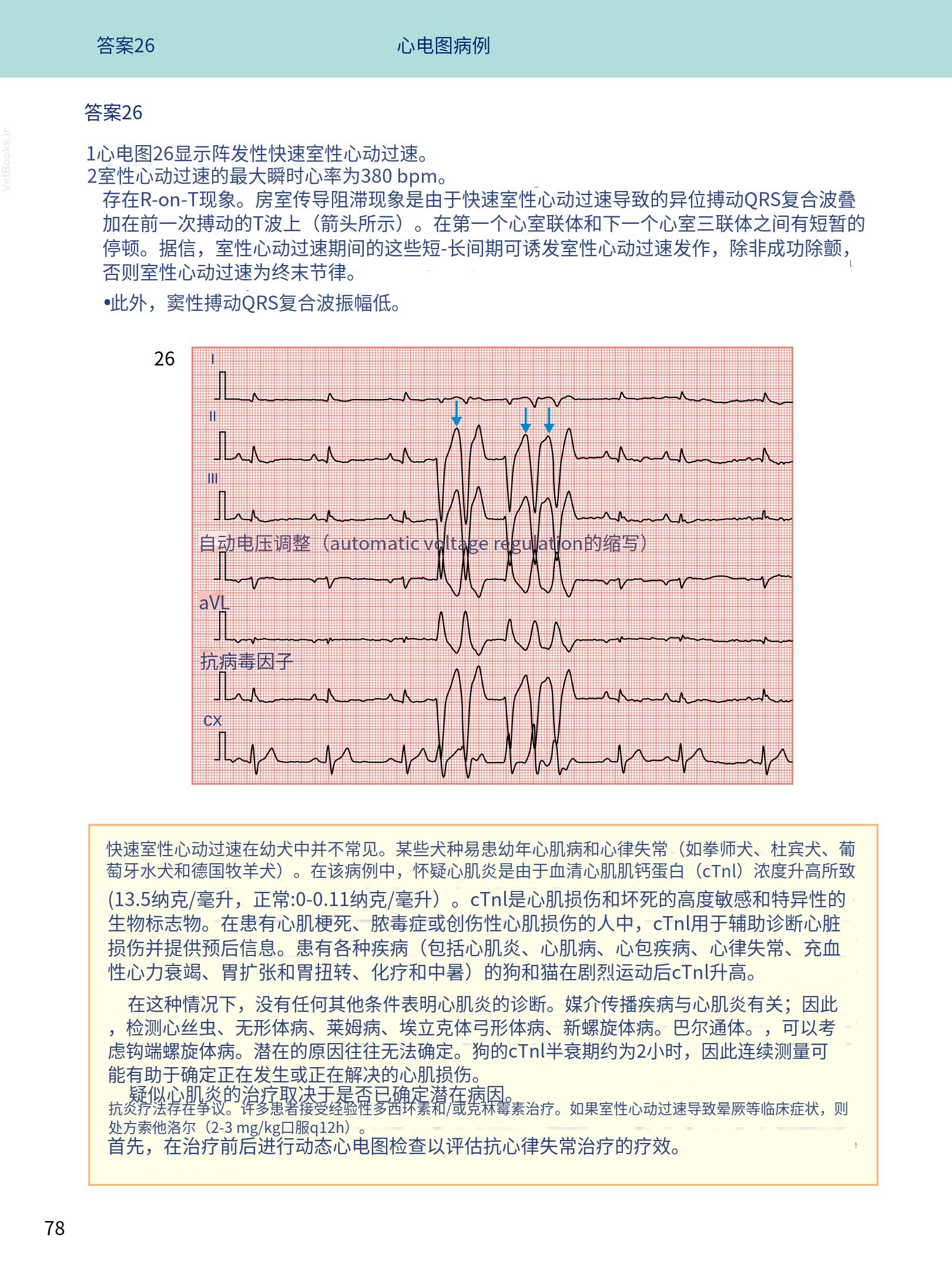 translated.08360f77efdd439f8d33c7a2dc6aedd5_91.png